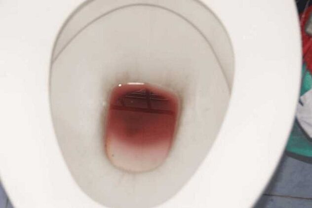 observation chez les hommes quand ils sont excités